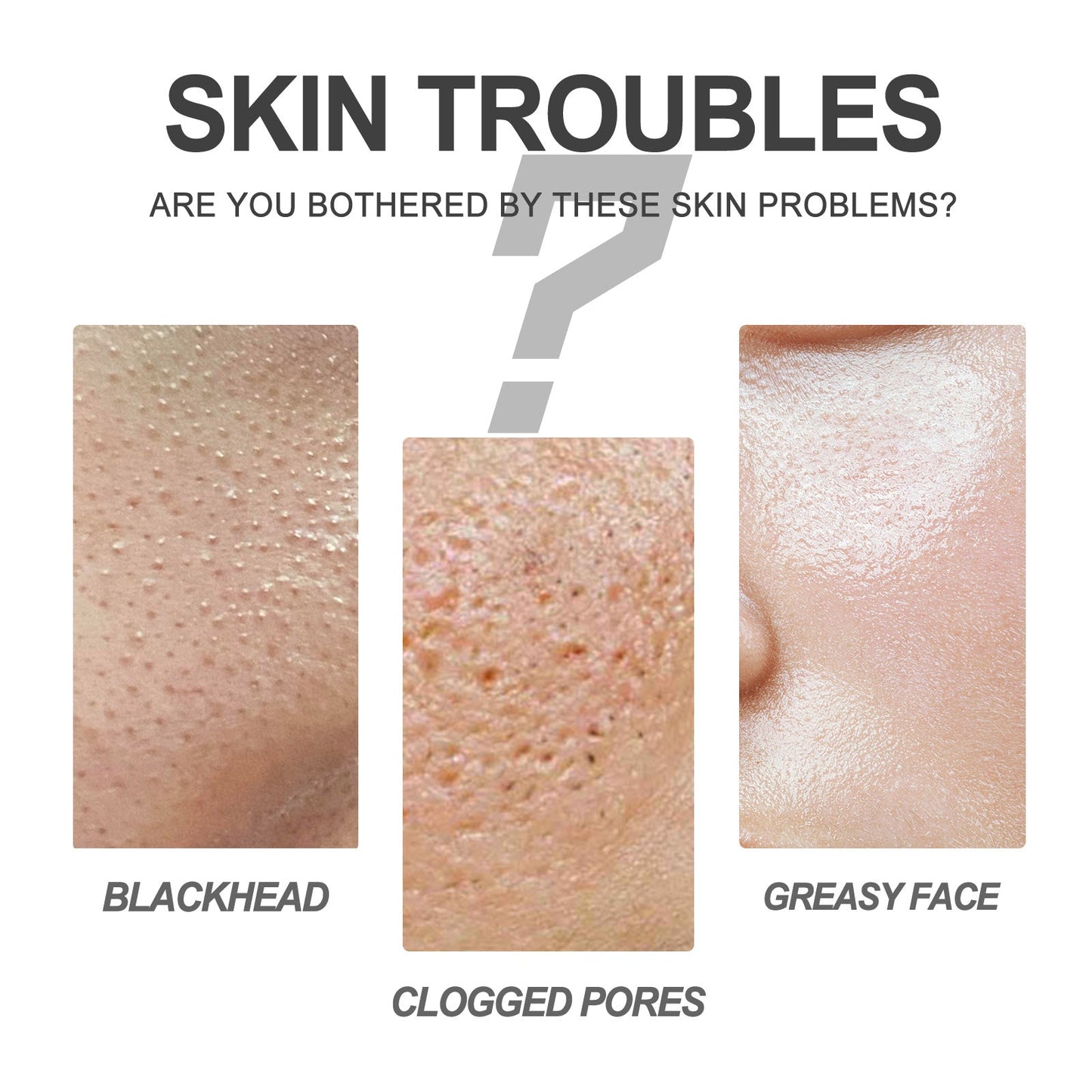 EELHOE Blackhead Cleansing Cream Skin Oil Blackheads Acne Exfoliating