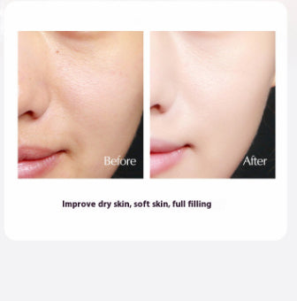 Dark Spot Eraser Brightening Cream for Acne Scars & Skin Tone Evenness