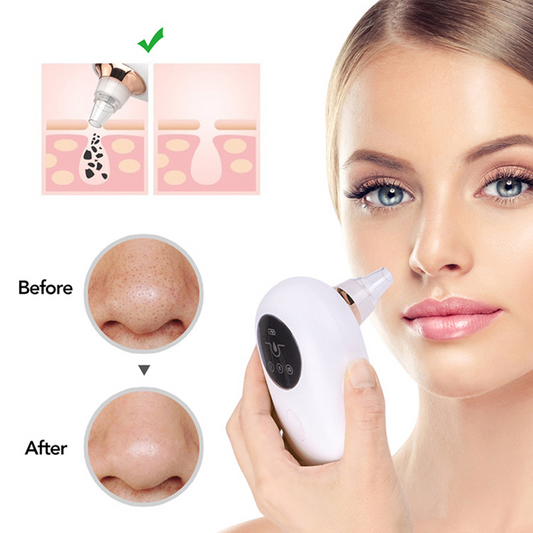 Portable Face Deep Pore Cleaner Vacuum Blackhead Remover
