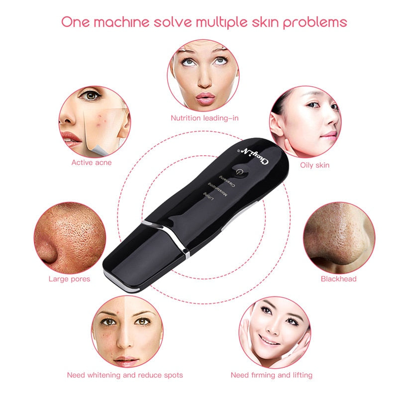 Ultrasonic Skin Scrubber Facial Cleaning Peeling Shovel Lifting