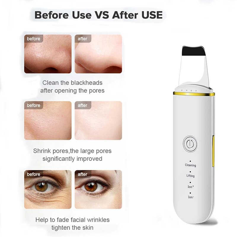 Ultrasonic Skin Scrubber Electric Vibration Deep Face Cleaning Peeling
