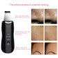 Ultrasonic Skin Scrubber Facial Cleaning Peeling Shovel Lifting