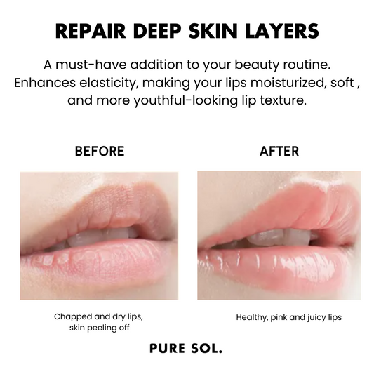 PURE SOL. Beauty Pucker Up Baby - Cherry Blossom Hydrogel Collagen Lip