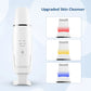 Ultrasonic Skin Scrubber EMS Vibration Ion Acne Pore Blackhead Remover